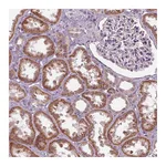 Atlas Antibodies Anti-ZNF605 Antibody