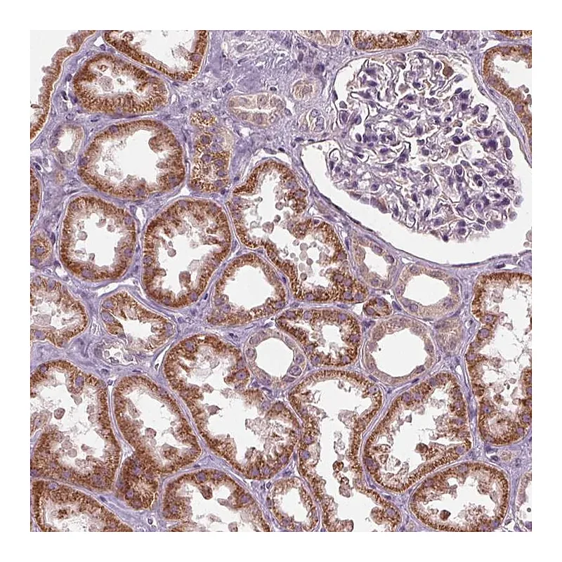 Atlas Antibodies Anti-ZNF605 Antibody