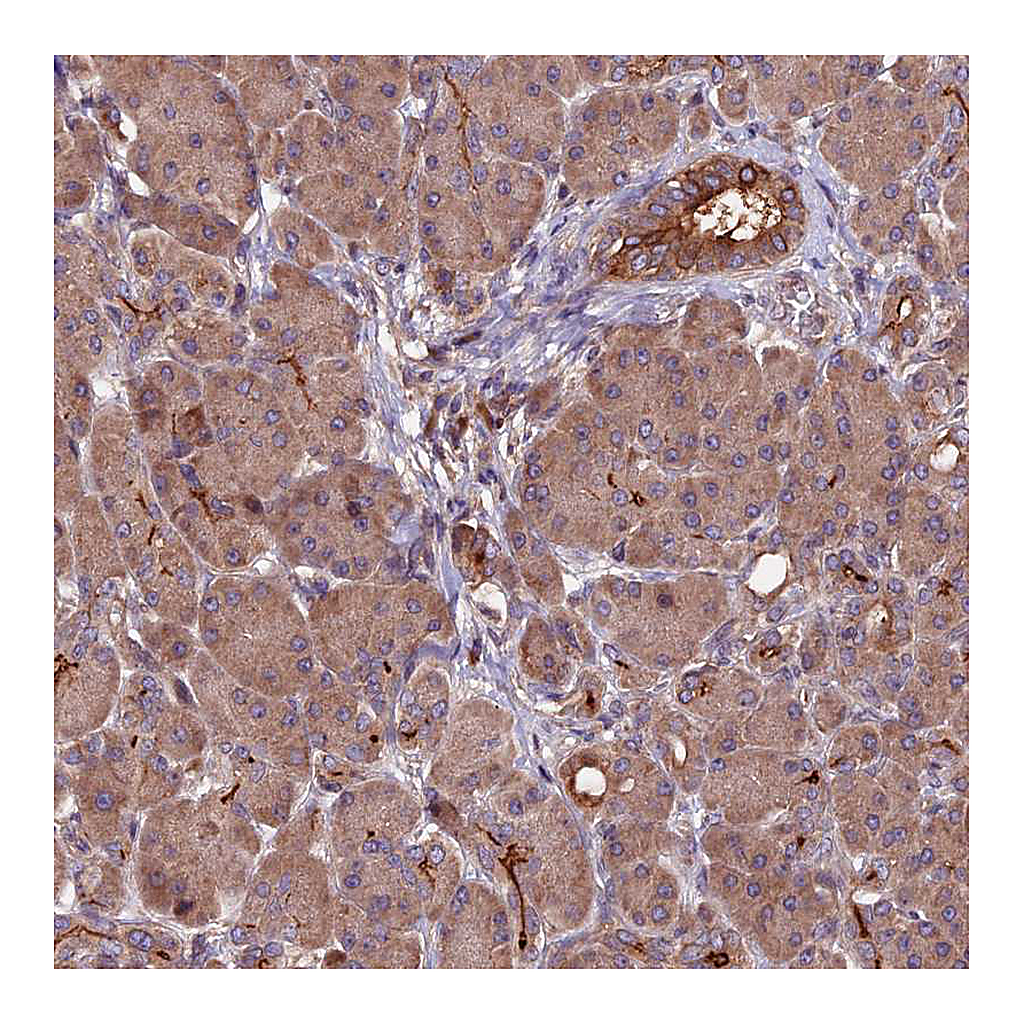 Atlas Antibodies Anti-ZNF598 Antibody