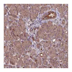 Atlas Antibodies Anti-ZNF598 Antibody