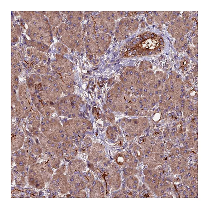 Atlas Antibodies Anti-ZNF598 Antibody
