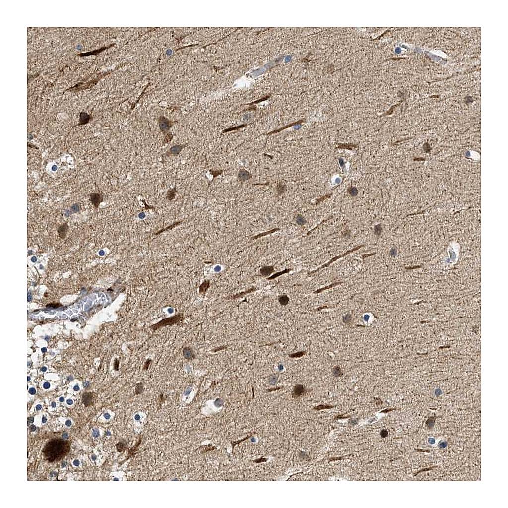 Atlas Antibodies Anti-ZNF599 Antibody