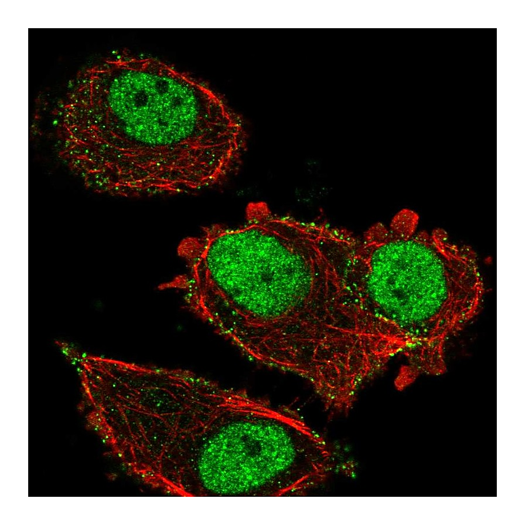 Atlas Antibodies Anti-ZNF605 Antibody