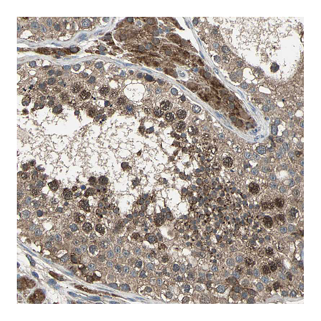 Atlas Antibodies Anti-ZNF608 Antibody