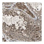 Atlas Antibodies Anti-ZNF608 Antibody