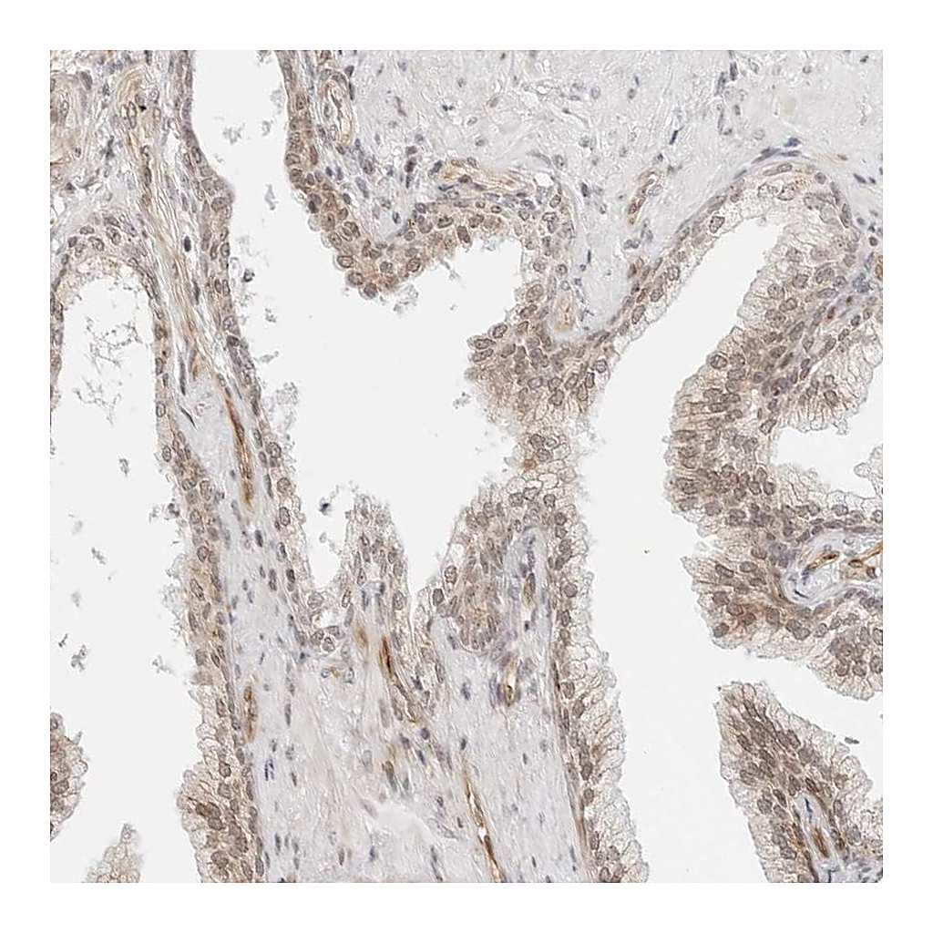 Atlas Antibodies Anti-ZNF613 Antibody