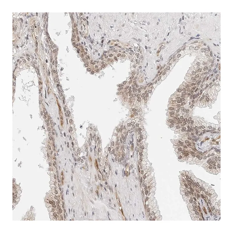 Atlas Antibodies Anti-ZNF613 Antibody