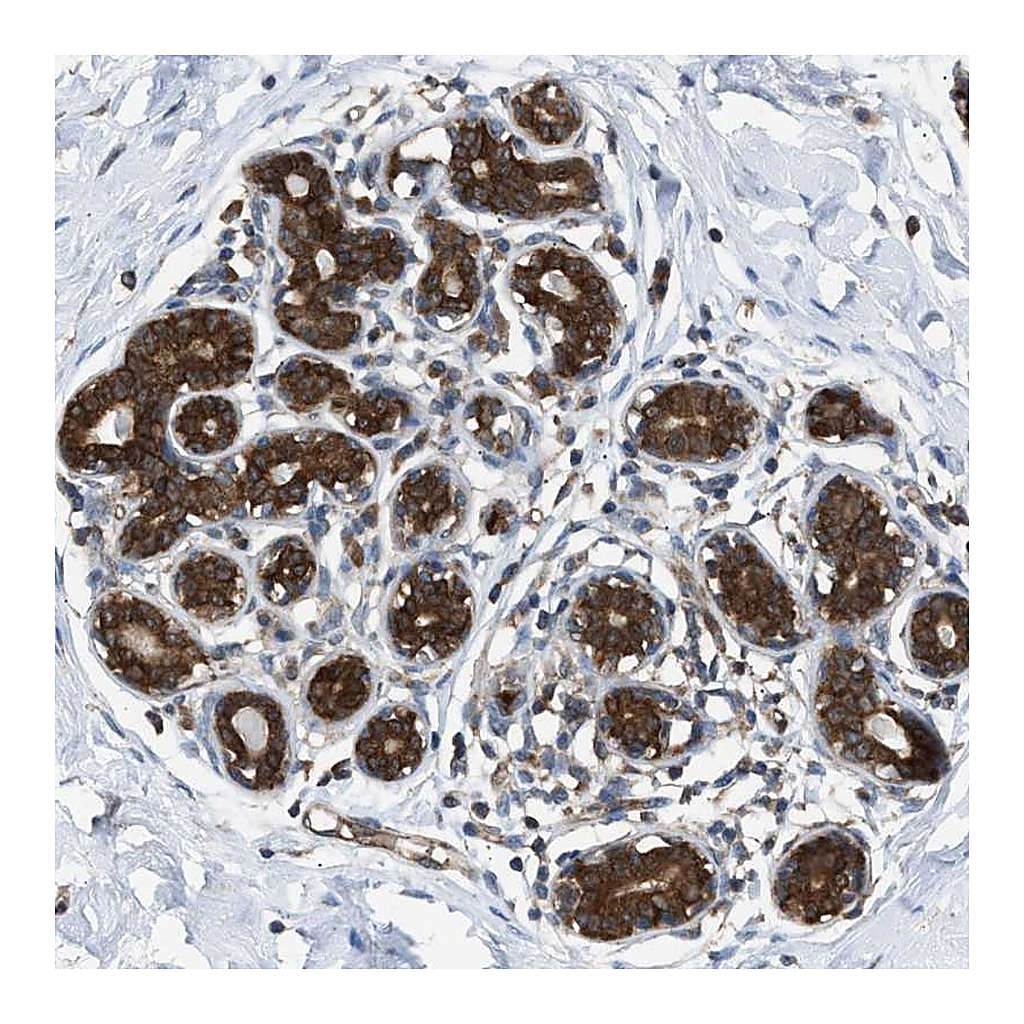 Atlas Antibodies Anti-ZNF614 Antibody