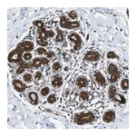 Atlas Antibodies Anti-ZNF614 Antibody