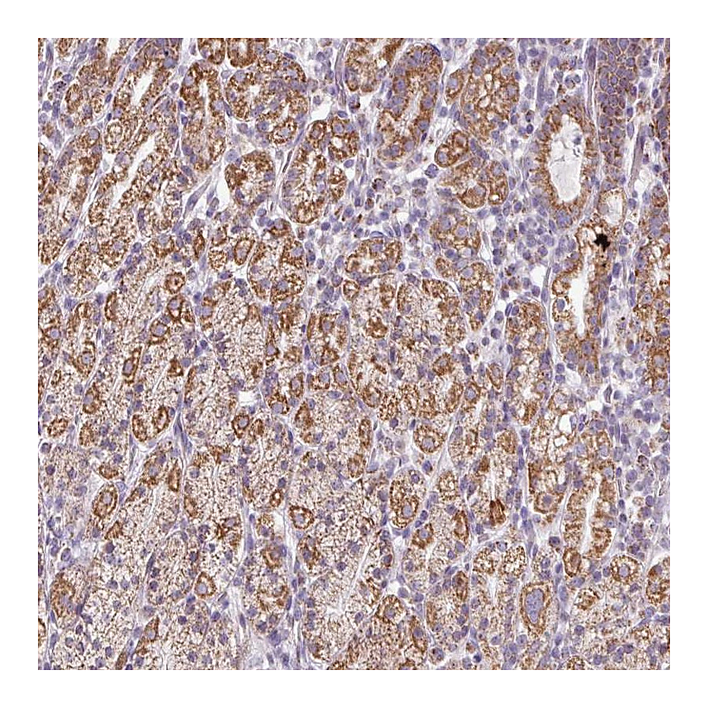 Atlas Antibodies Anti-ZNF615 Antibody