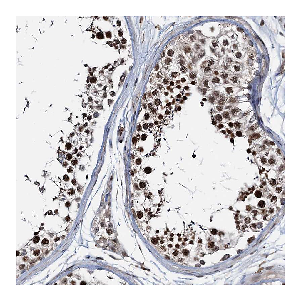Atlas Antibodies Anti-ZNF609 Antibody