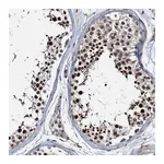 Atlas Antibodies Anti-ZNF609 Antibody