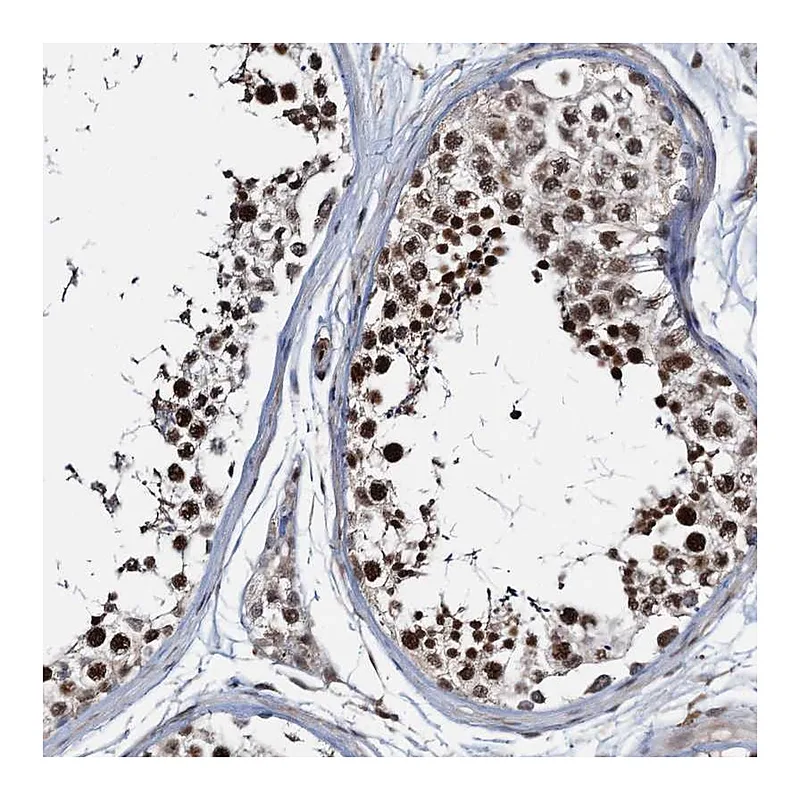 Atlas Antibodies Anti-ZNF609 Antibody