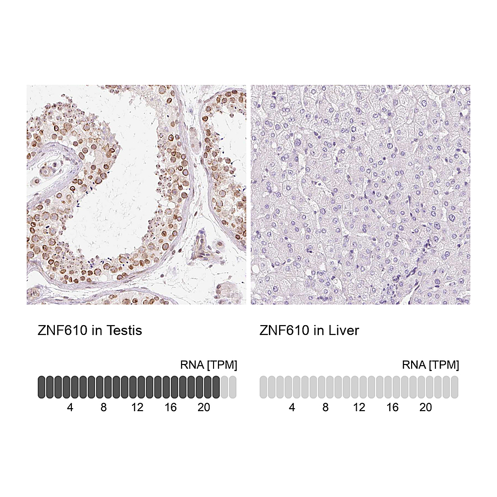 Atlas Antibodies Anti-ZNF610 Antibody