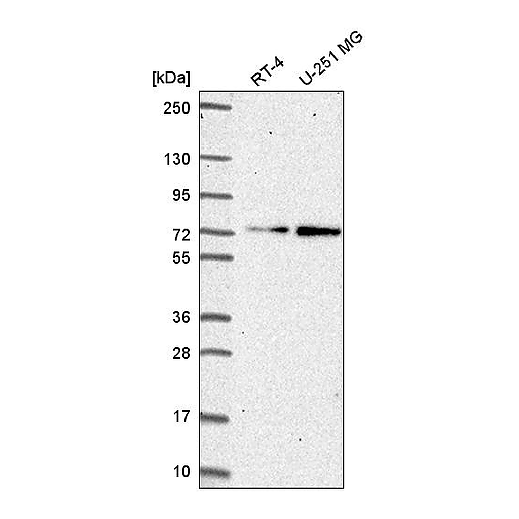 Atlas Antibodies Anti-ZNF616 Antibody