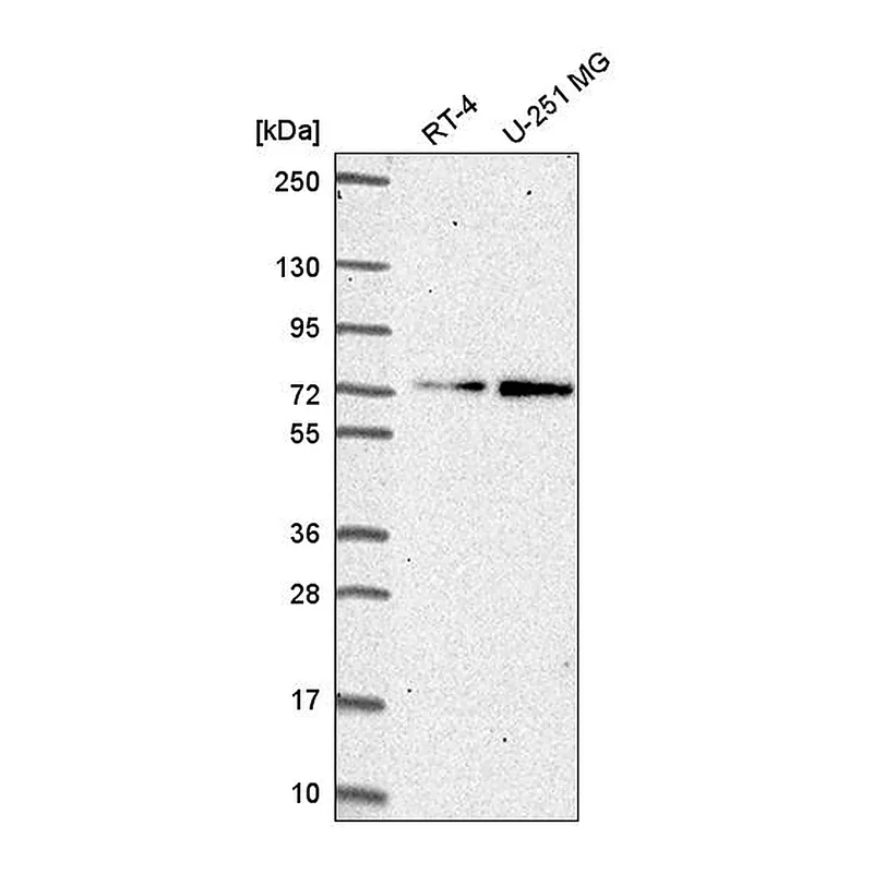 Atlas Antibodies Anti-ZNF616 Antibody