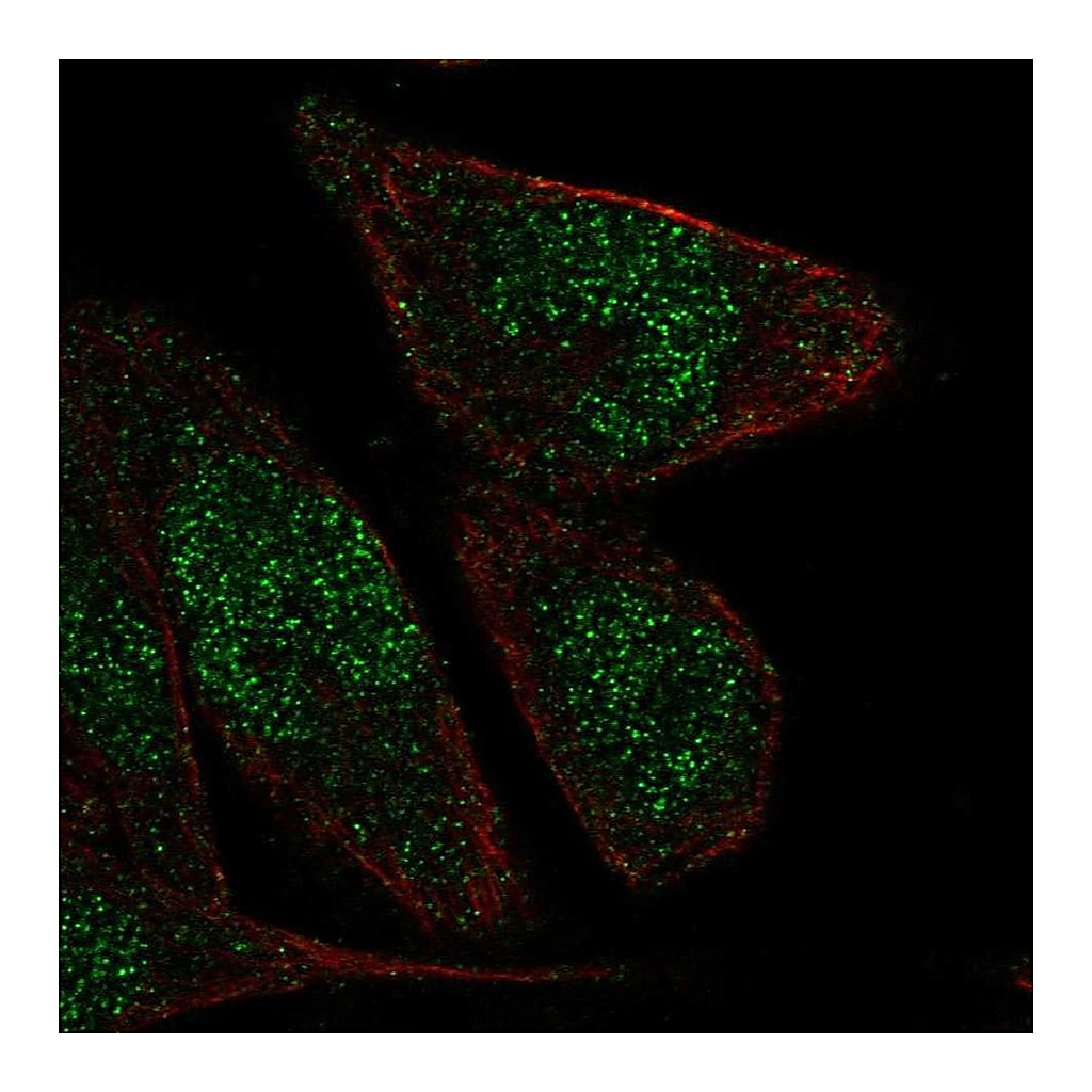 Atlas Antibodies Anti-ZNF610 Antibody