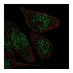 Atlas Antibodies Anti-ZNF610 Antibody
