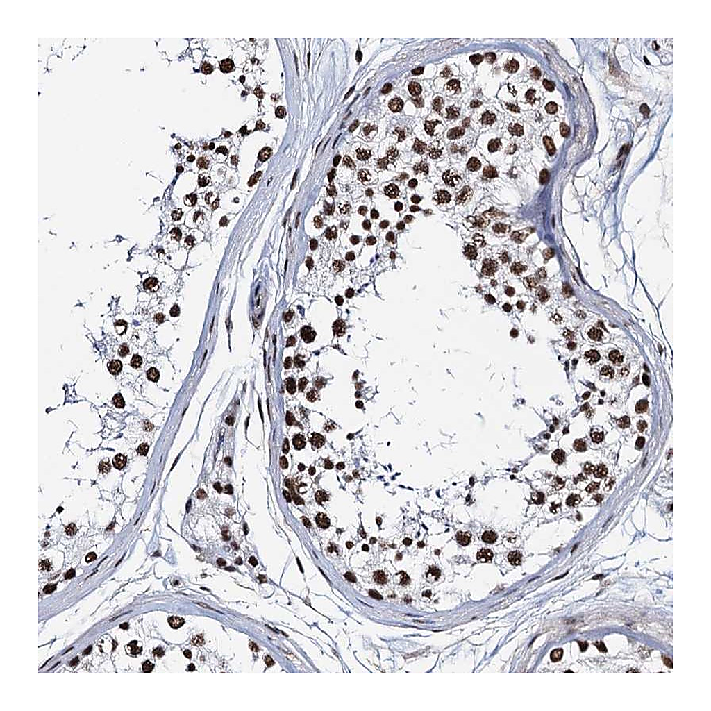 Atlas Antibodies Anti-ZNF609 Antibody
