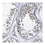 Atlas Antibodies Anti-ZNF609 Antibody