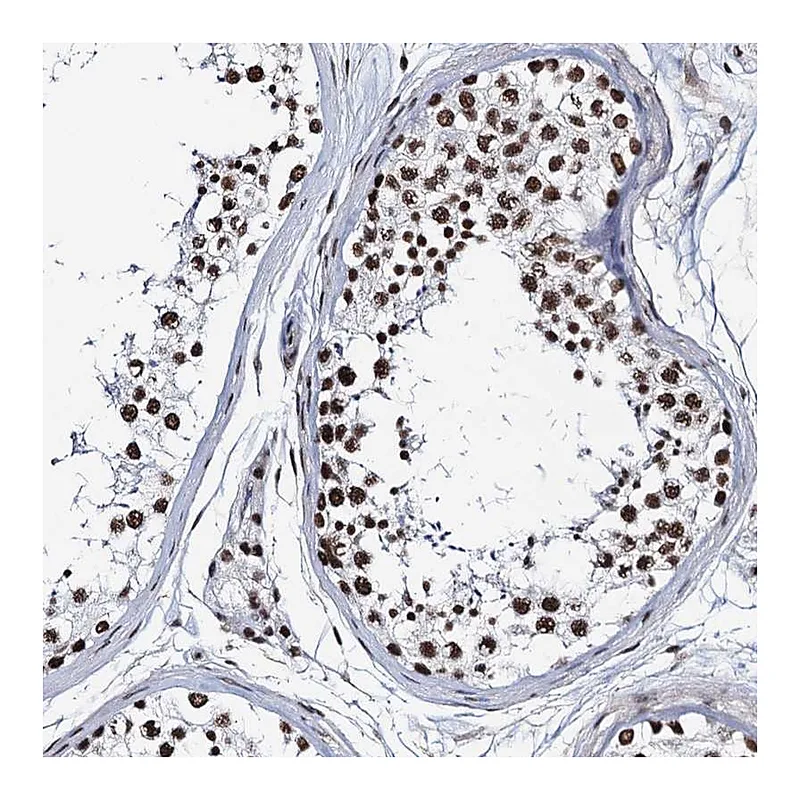 Atlas Antibodies Anti-ZNF609 Antibody