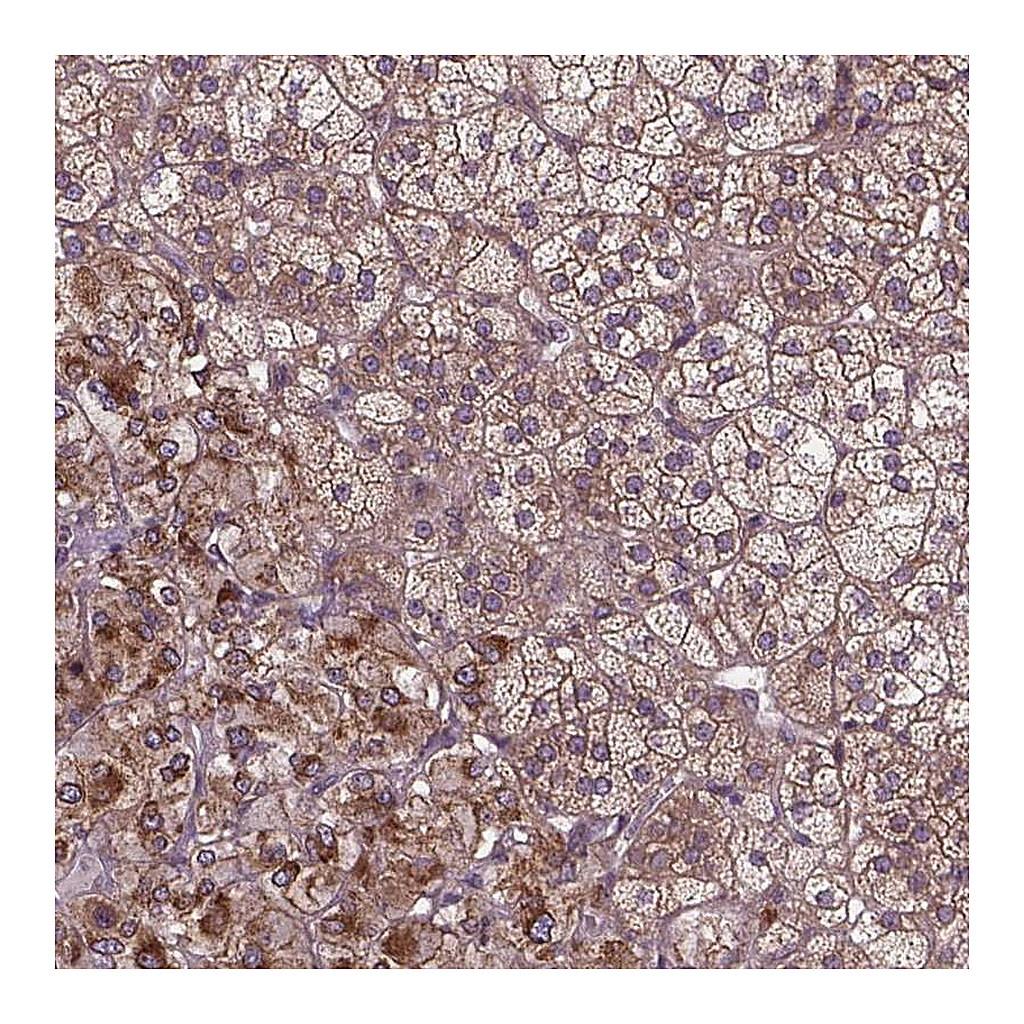 Atlas Antibodies Anti-ZNF616 Antibody