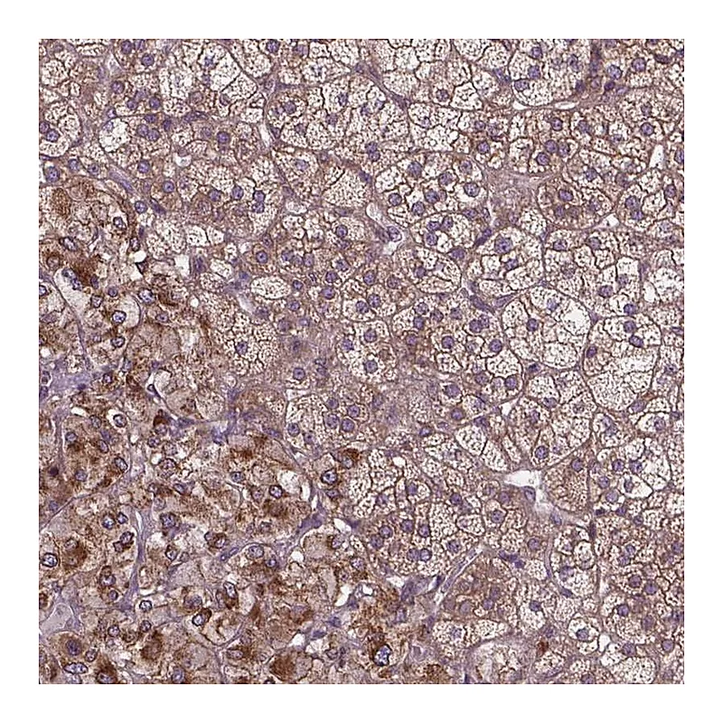 Atlas Antibodies Anti-ZNF616 Antibody