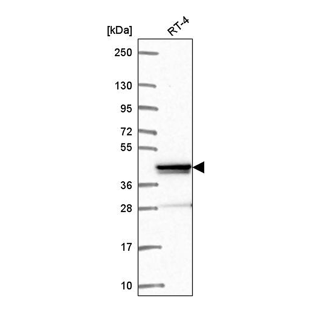 Atlas Antibodies Anti-ZNF618 Antibody
