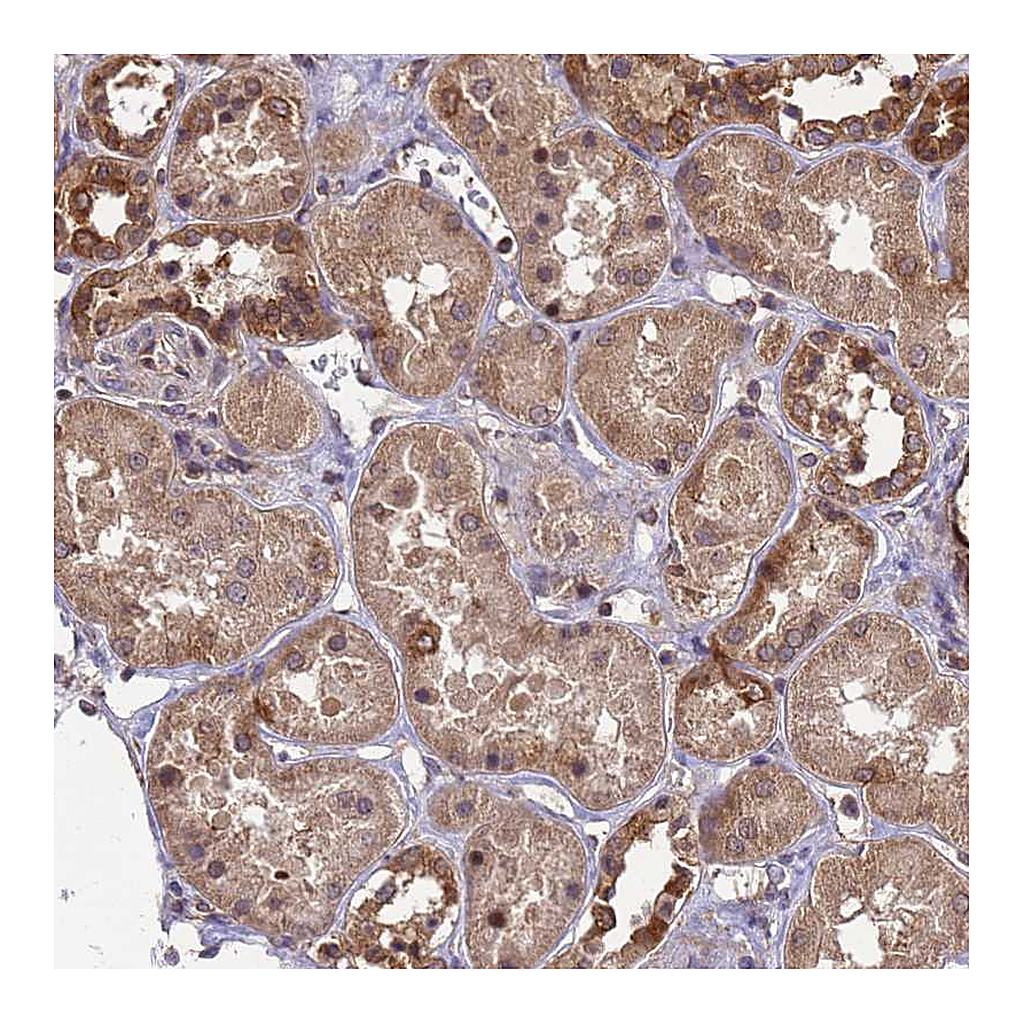 Atlas Antibodies Anti-ZNF618 Antibody