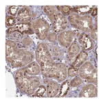 Atlas Antibodies Anti-ZNF618 Antibody
