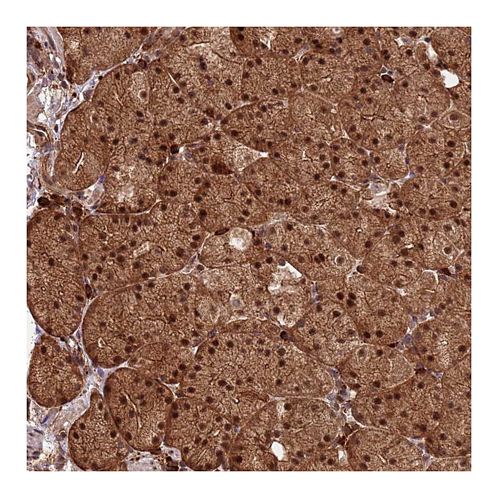 Atlas Antibodies Anti-ZNF619 Antibody