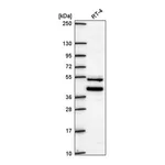 Atlas Antibodies Anti-ZNF621 Antibody