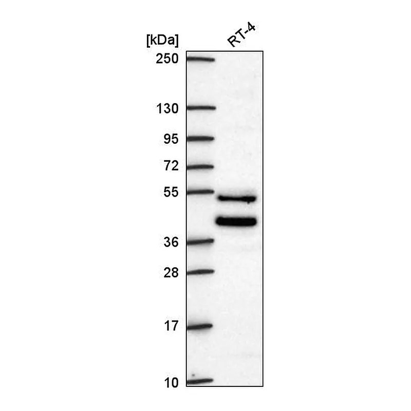 Atlas Antibodies Anti-ZNF621 Antibody