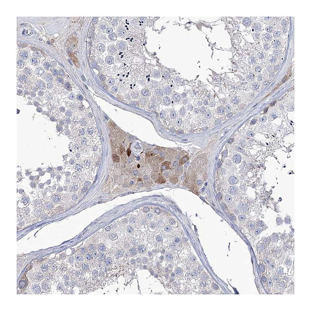 Atlas Antibodies Anti-ZNF622 Antibody