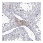 Atlas Antibodies Anti-ZNF622 Antibody