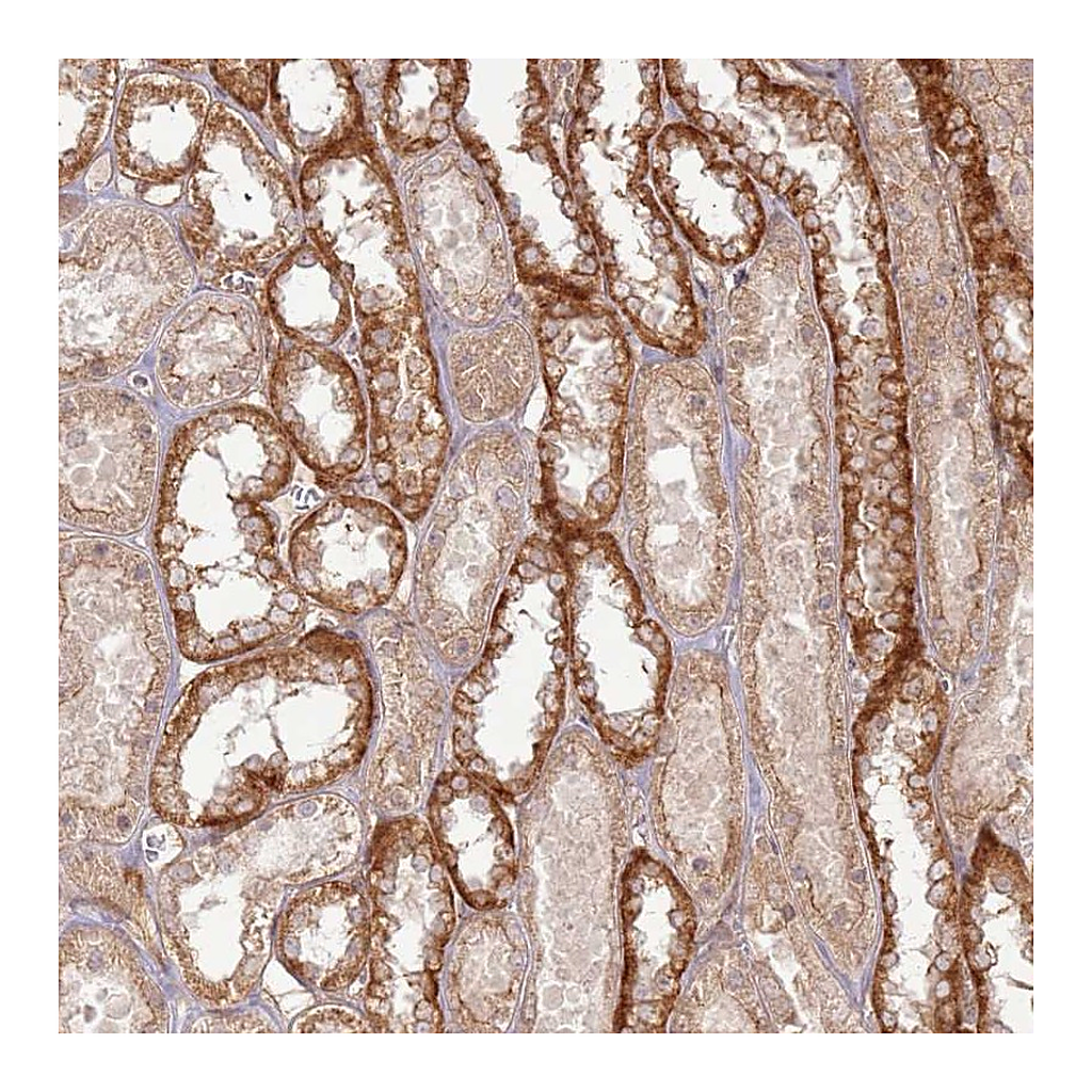 Atlas Antibodies Anti-ZNF623 Antibody