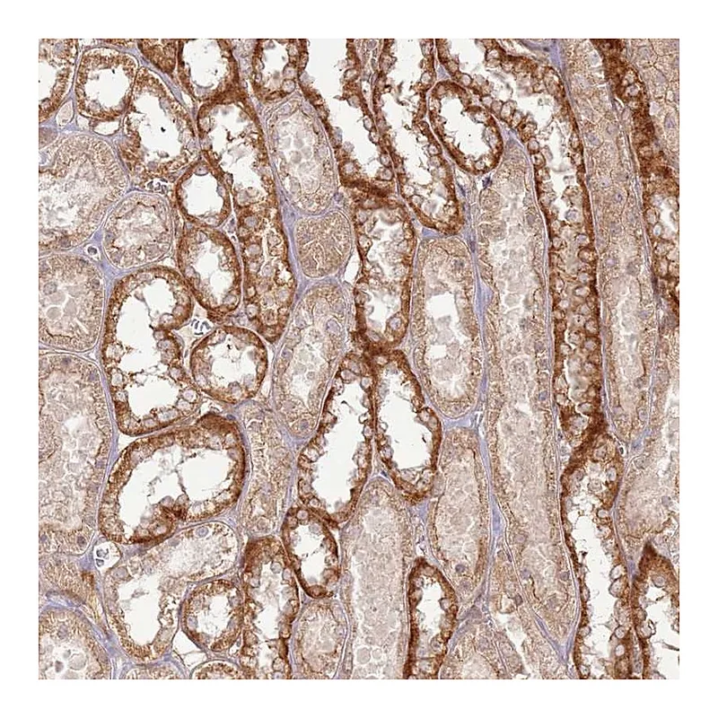 Atlas Antibodies Anti-ZNF623 Antibody