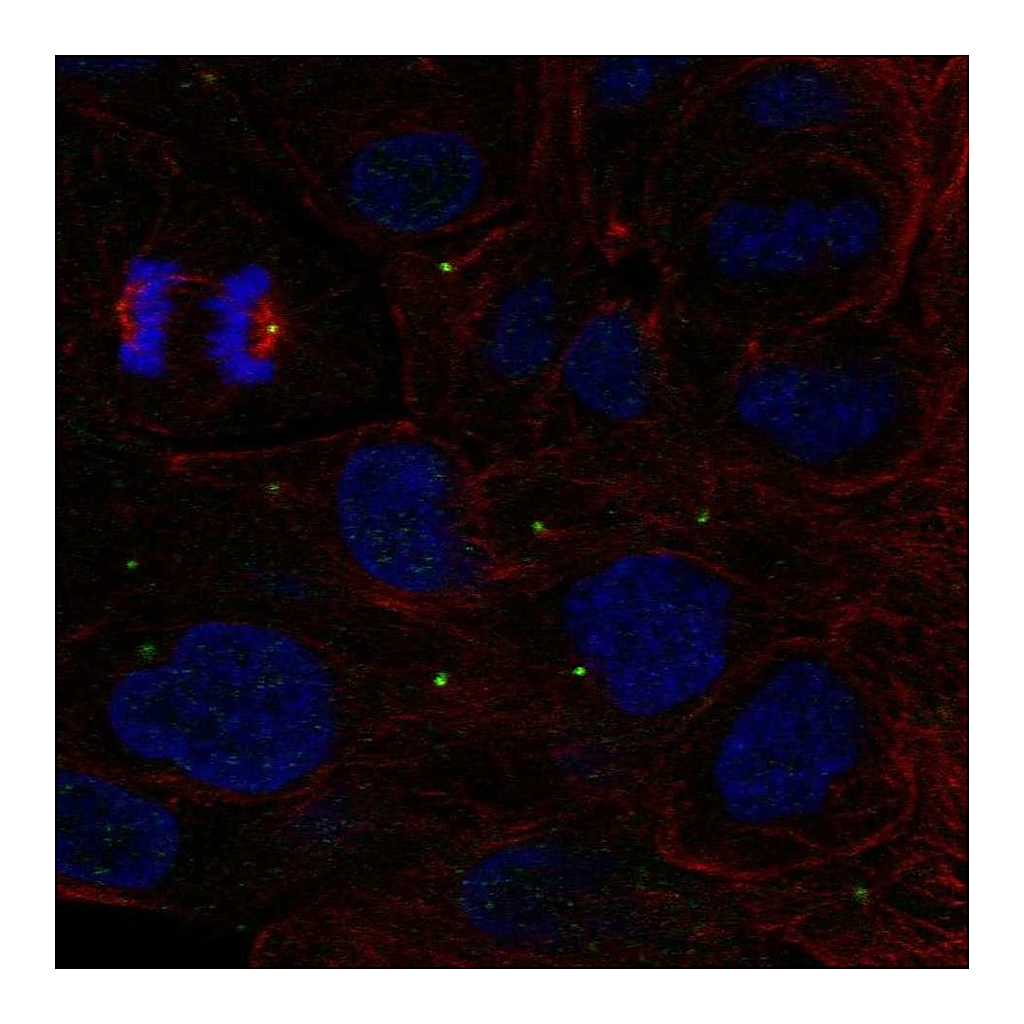 Atlas Antibodies Anti-ZNF620 Antibody