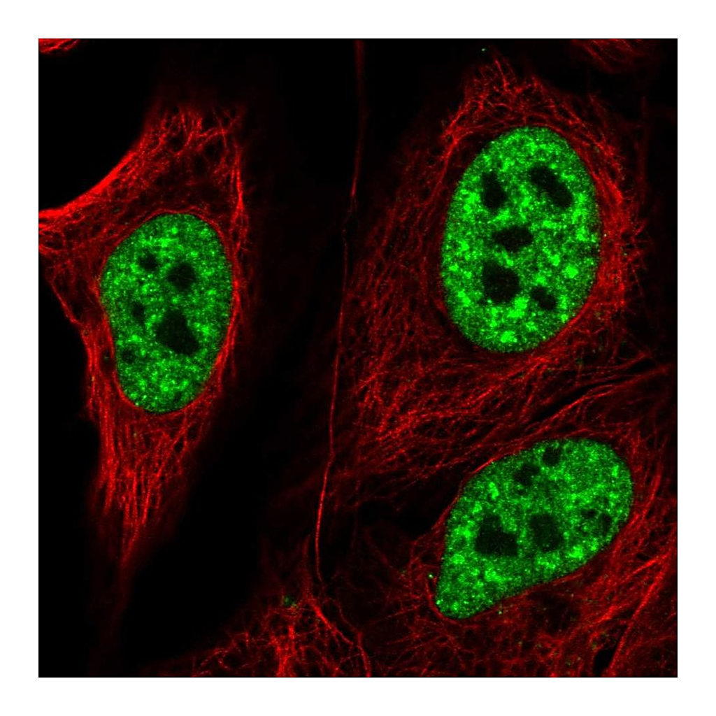 Atlas Antibodies Anti-ZNF621 Antibody