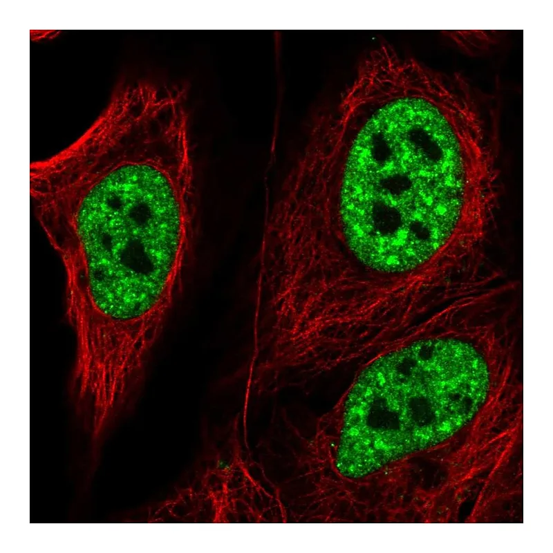 Atlas Antibodies Anti-ZNF621 Antibody