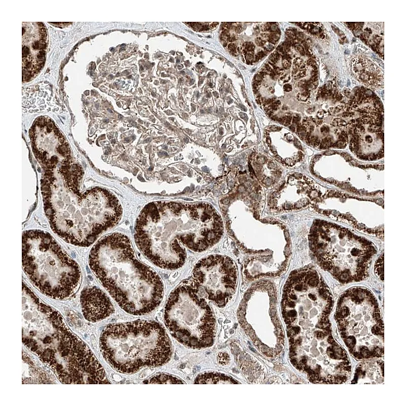 Atlas Antibodies Anti-ZNF620 Antibody