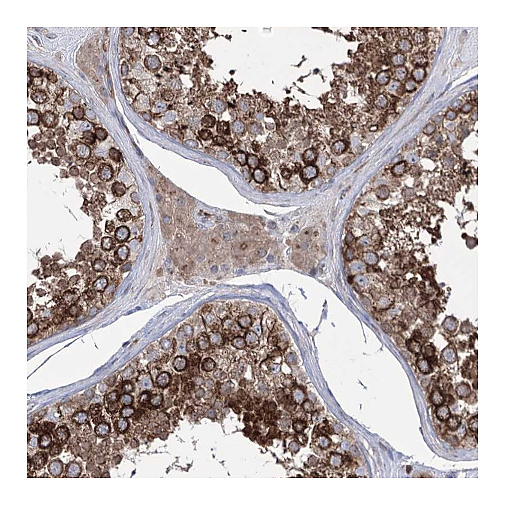 Atlas Antibodies Anti-ZNF622 Antibody