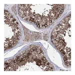 Atlas Antibodies Anti-ZNF622 Antibody