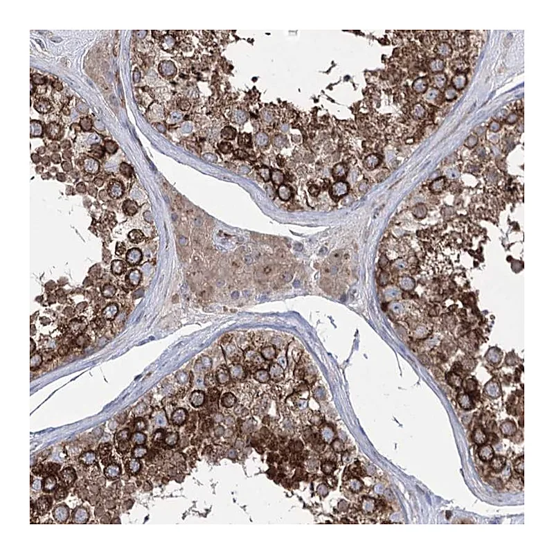 Atlas Antibodies Anti-ZNF622 Antibody