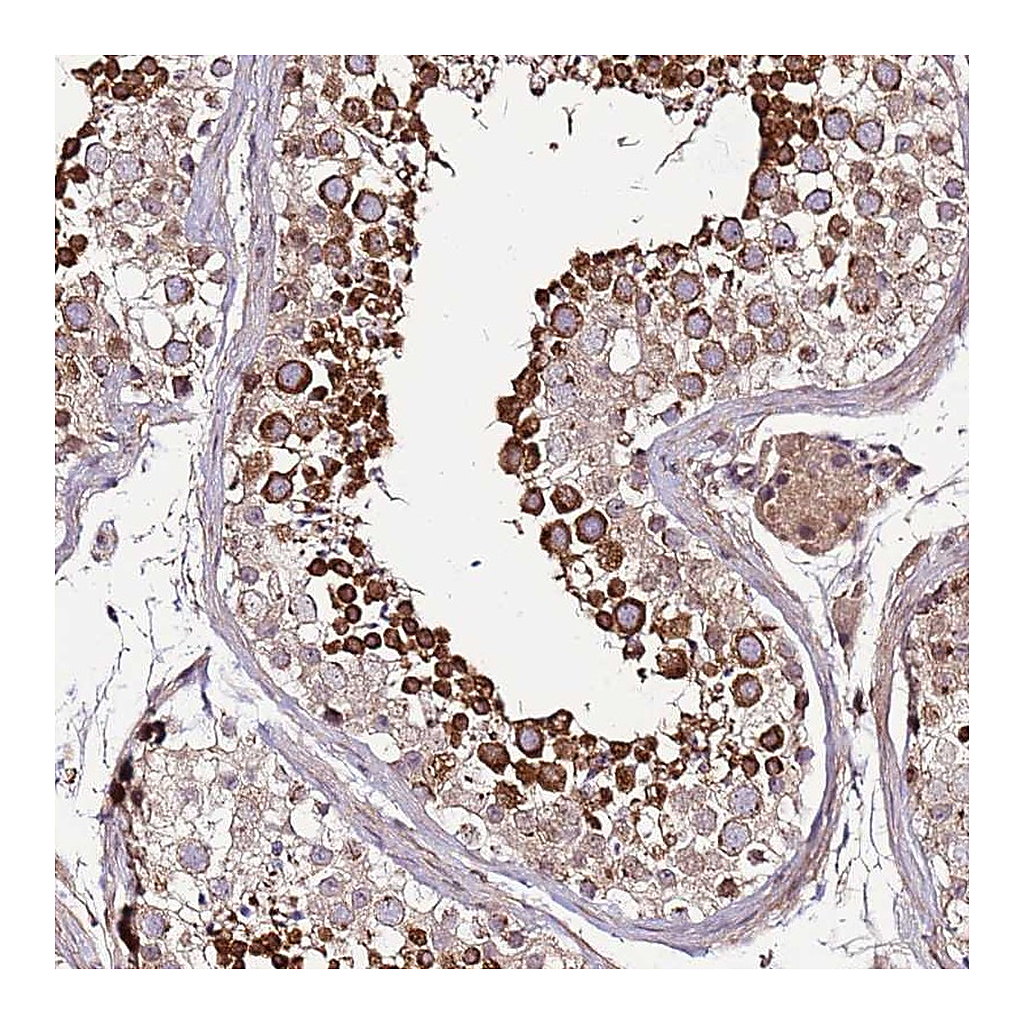 Atlas Antibodies Anti-ZNF624 Antibody