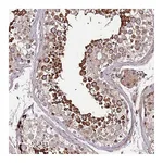 Atlas Antibodies Anti-ZNF624 Antibody