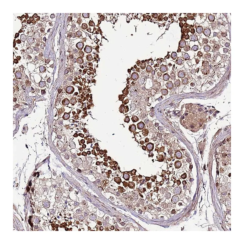 Atlas Antibodies Anti-ZNF624 Antibody