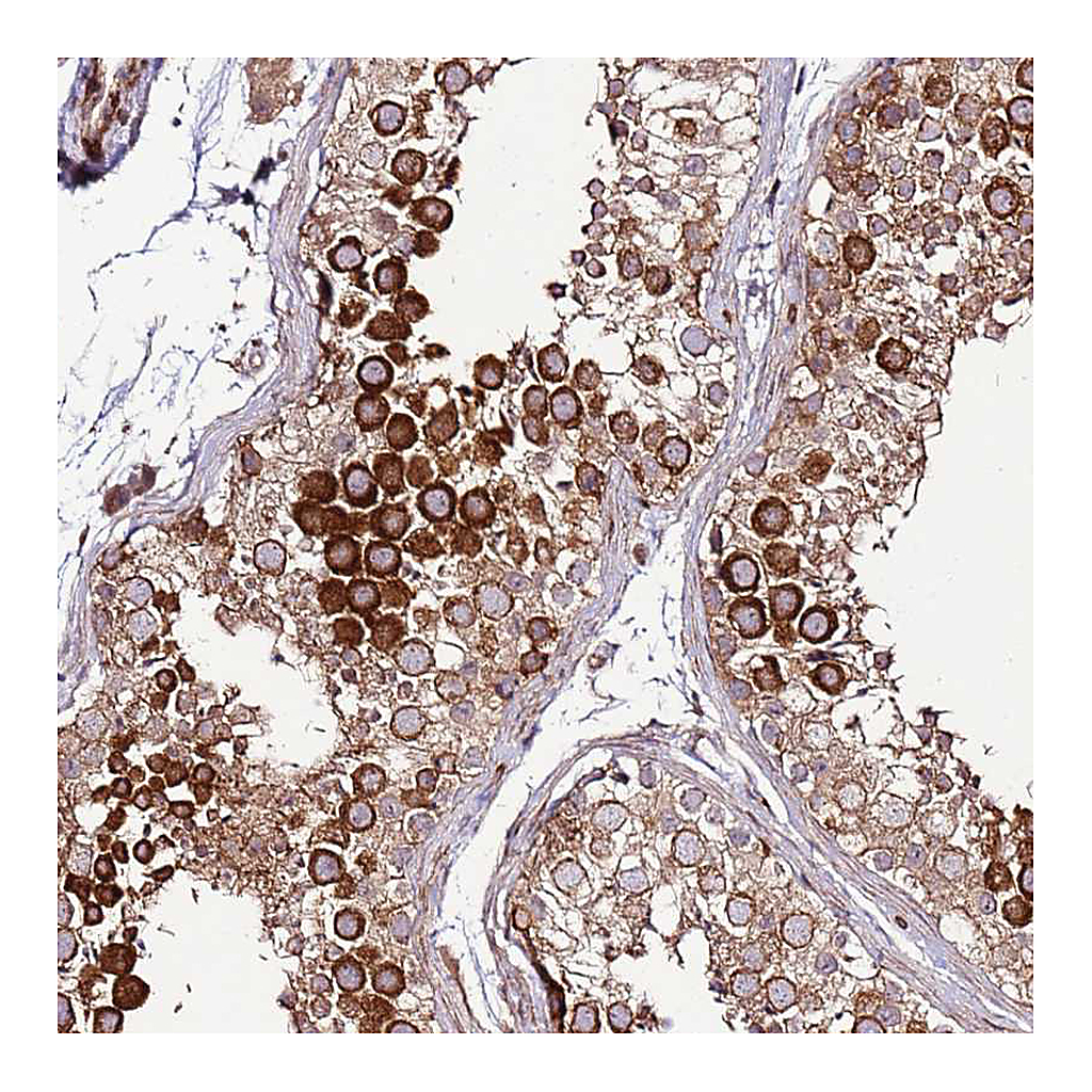 Atlas Antibodies Anti-ZNF624 Antibody
