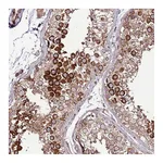 Atlas Antibodies Anti-ZNF624 Antibody