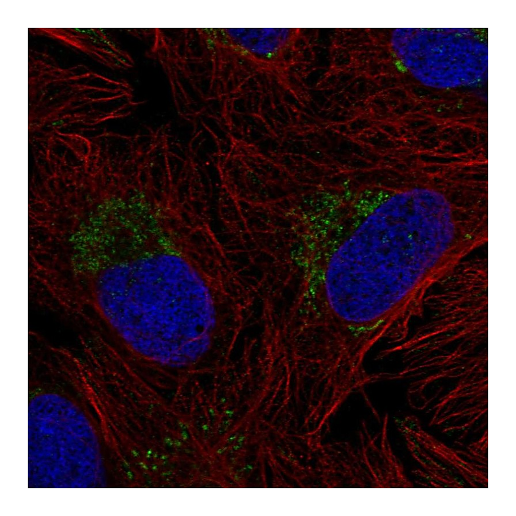 Atlas Antibodies Anti-ZNF625 Antibody